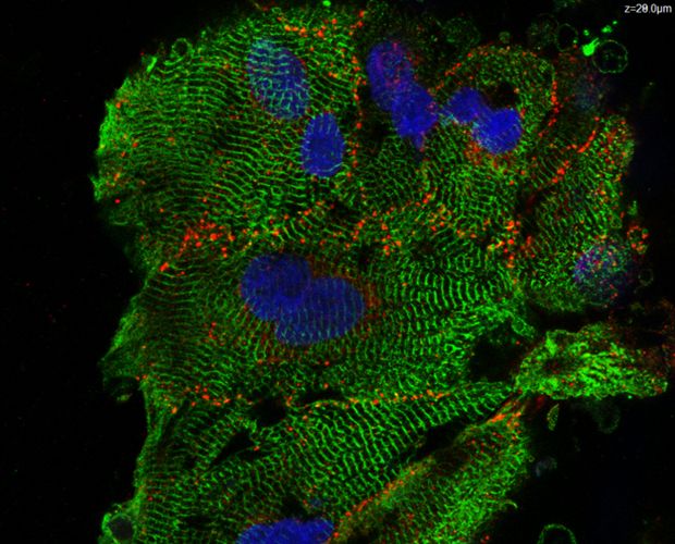 Fluoreszenz Aufnahme von Kardiomyozyten Sphaeroid Fluoreszenz Aufnahme von Kardiomyozyten Sphaeroid