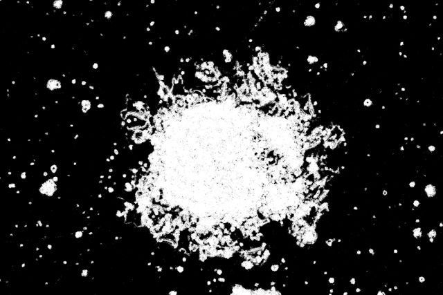 Computergestuetzte Wachstumsanalyse einer iPSC Kolonie