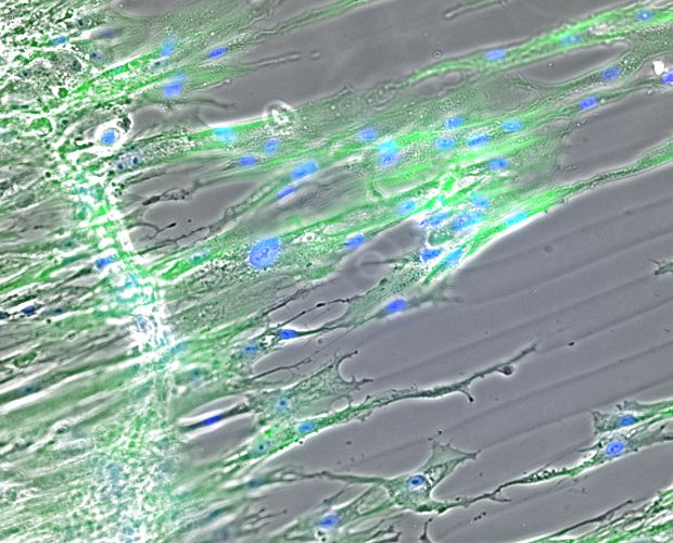 Adhaerente Zellen auf Alginatstrukturen