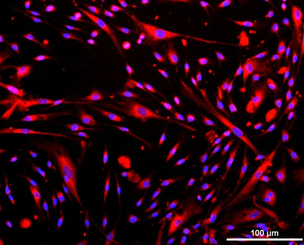 Adherent Cells on alginat structure collagen coating