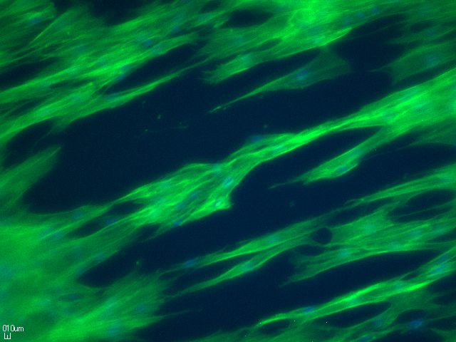 Adherent Cells on alginat structure