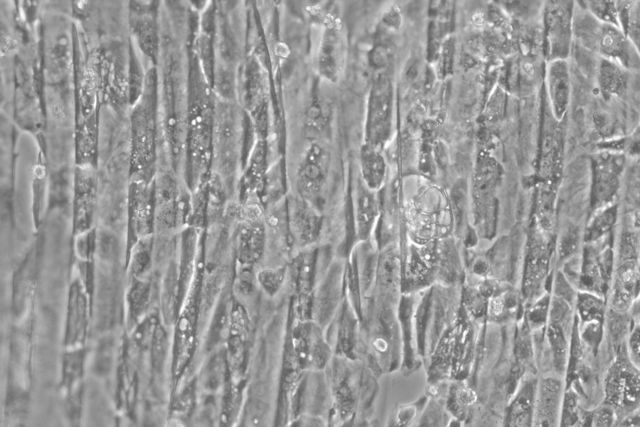 Cardiomyocytes on alginat scaffold