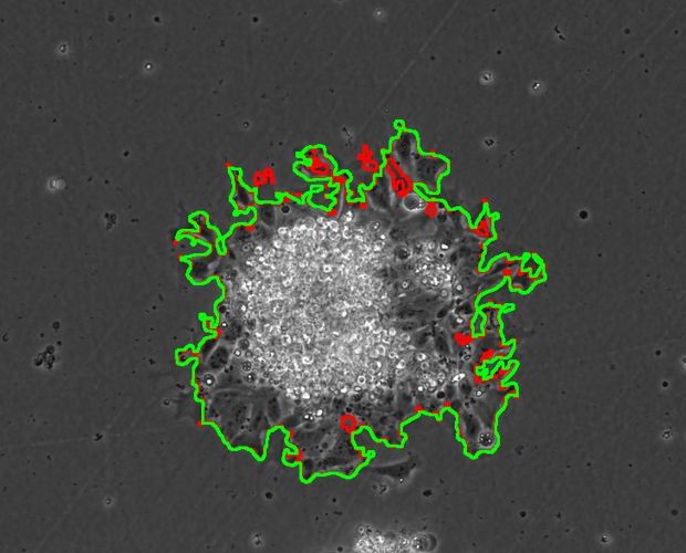 Computer aided growth analysis hiPSC colony