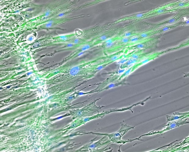 Stained MSCs on printed alginate structures.