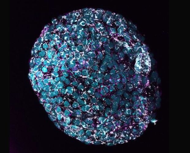 View cardiomyocyte spheroid fluorescence image
