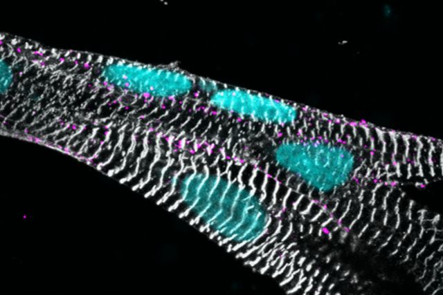 ICC sarcomere matured heart muscle cells